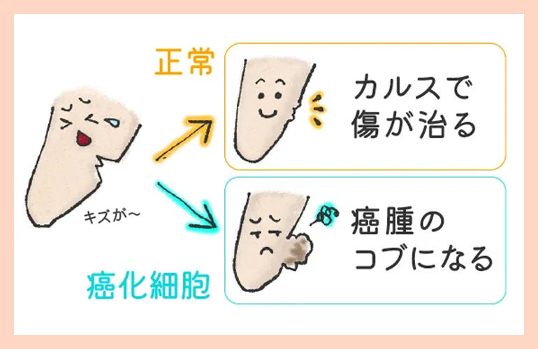 根頭がんしゅ病　こぶの仕組み